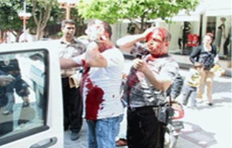 Araç Park Etme Kavgası