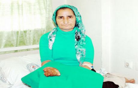 Böbreğinden Elma Kadar Taş Çıktı!
