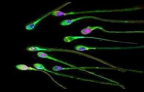 Erkekler! Sperm Sayınız Düşebilir!