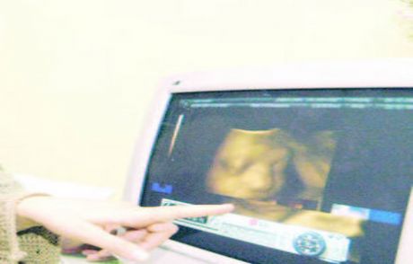 Bebeğinizin Cinsiyetini 2. Ayda Öğrenin!
