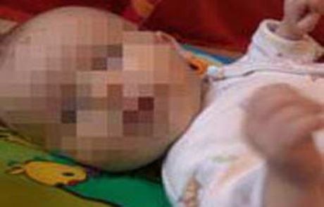Doktorlar Kavgaya Tutuştu Bebek Ölü Doğdu