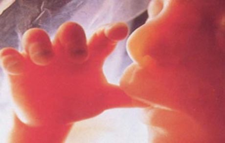 Kürtajdan Sonra Öldü Sandılar Yaşadı