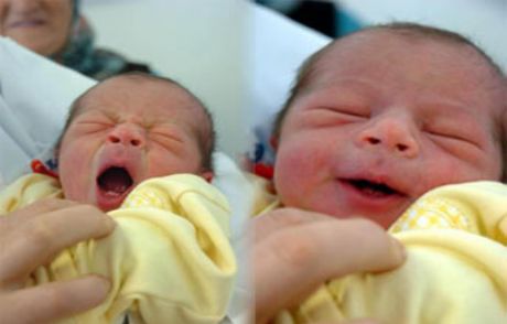 16 Gün Gecikme Ve 2 Dişiyle Doğdu