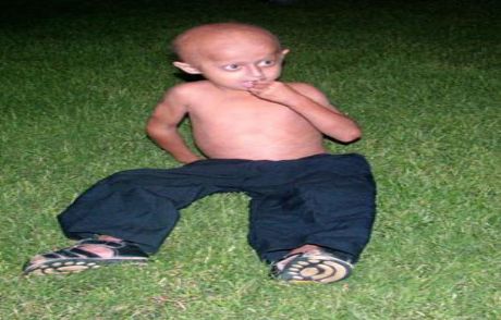12 Yaşında, Yaşlılıktan Öldü
