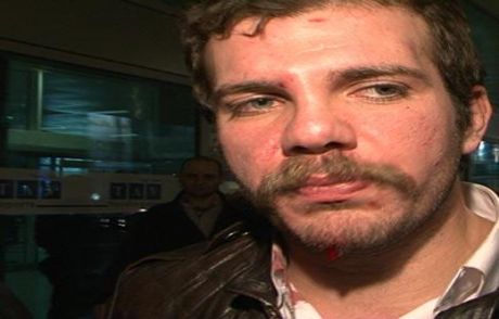 Tolga: Sevgilisinden Ayrılmaya Katlanamadı