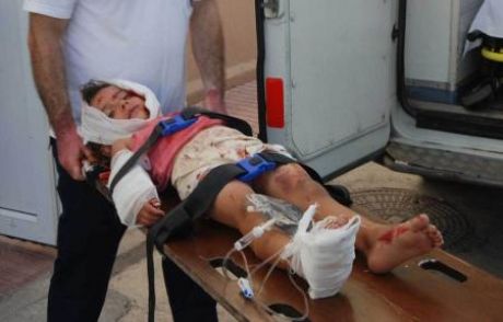 4 Yaşındaki Tülay, Bir Günde İki Kaza Yaşadı