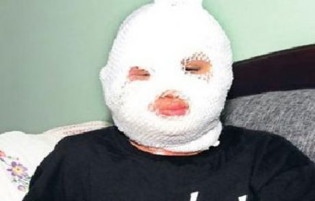Çakmak Gazıyla Arkadaşını Yaktı