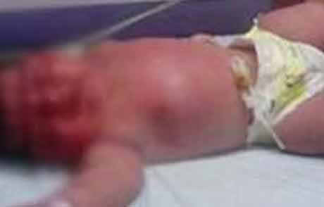 Minik Bebek Hamile Çıktı !