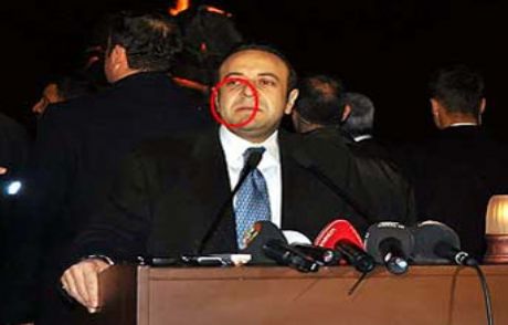 Bakana Yumurtalı Saldırı