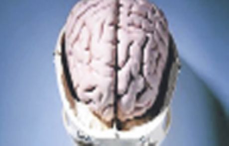 Beyin Alzheimer'dan Önce Küçülüyor