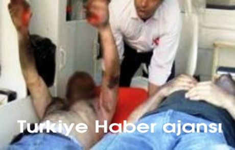 Trafo Patladı 2 İşçi Ağır Yaralı