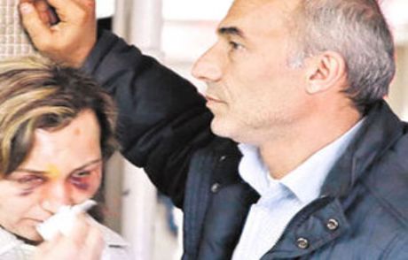 Şiddet Uygulayan Erkeğe Elektronik Kelepçe
