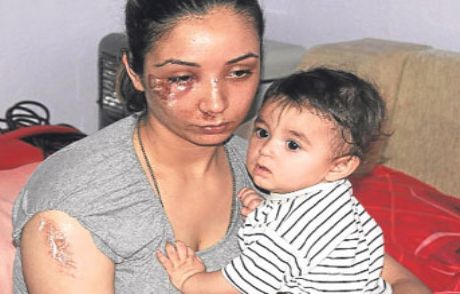 Koca Dayağı Bu Hale Getirdi