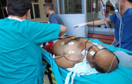 Ailelerin Çocuk Kavgası; 4 Ölü, 8 Yaralı