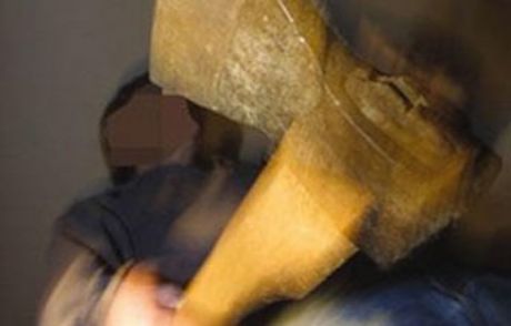 Baltalı Akıl Hastası Dehşet Saçtı