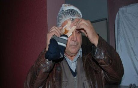 Mhp'li Başkana Dayak Suçlaması