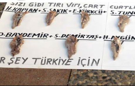 Milletvekillerinin Dillerini Kesti