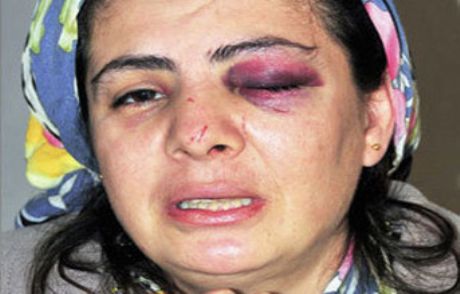 Eşinden 7 Saat Dayak Yedi!