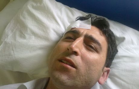 Servis Şoförleri Öğretmeni Dövdüler