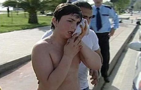 Denizde Pitbull Saldırısı