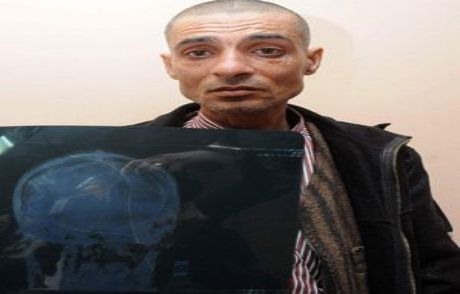 Başı İğne Tarlası Gibi
