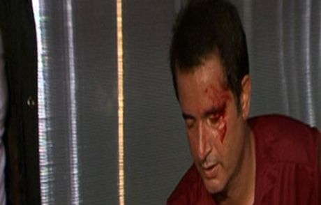 Acun Kanlar İçerisinde