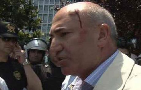 Chp'li Vekilin Kafası Yarıldı!