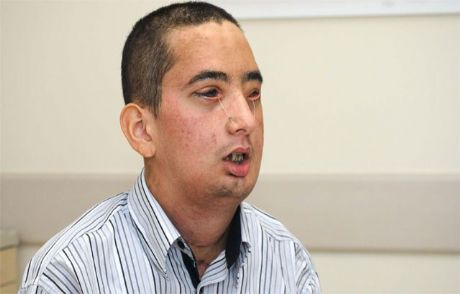 Çolak: En Güzeli Benim Yüzüm
