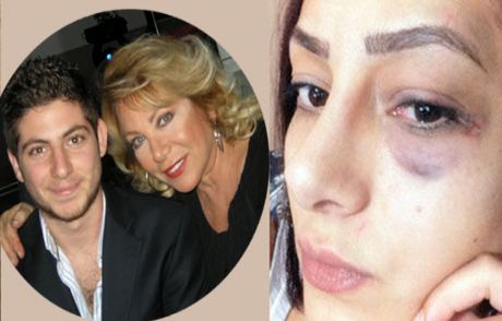 'nil Burak'ın Oğlu Beni Yumrukladı'
