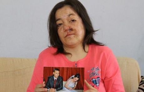 Kocası Bu Hale Getirdi!