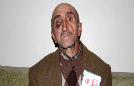 Baba'ya Bedelli Dayağı