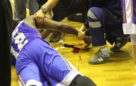 Basketbol Maçında Korkutan Kaza!
