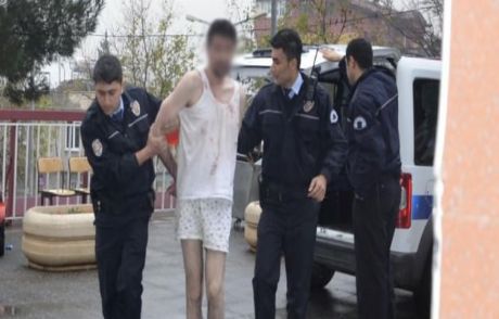 Annesinin Yüzünü Parçaladı!