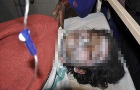 Tecavüze Uğrayan Genç Kız Kendini Yaktı