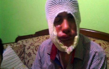Zihinsel Engelli Çocuğu Tiner Döküp Yaktılar