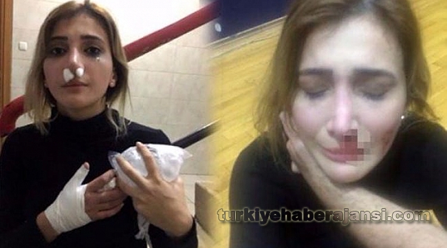 Kadın Yöneticiye Yumruk ve Tekmeli Saldırı