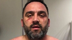 Beşiktaşlı Yönetici Bu Hale Geldi!