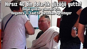 Hırsız 40 Bin Dolarlık Yüzüğü Yuttu! 