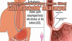 Gizli Hastalık Akalazyaya Dikkat!