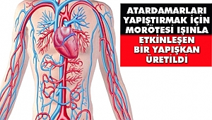 Atardamarları yapıştırmak İçin Morötesi Işınla Etkinleşen Bir Yapışkan