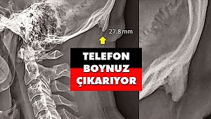 Telefon Boynuz Çıkarıyor