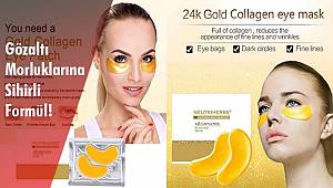 Gözaltı Morluklarına Sihirli Formül!