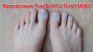 Koronavirüsün Yeni Belirtisi Tespit Edildi!