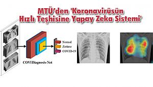 MTÜ’den 'Koronavirüsün Hızlı Teşhisine Yapay Zeka Sistemi'