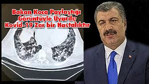Bakan Koca Paylaştığı Görüntüyle Uyardı; Kovid-19 Zor bir Hastalıktır
