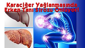 Karaciğer Yağlanmasında Erken Tanı Sirozu Önlüyor!
