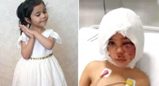 Pitbull saldırısına uğramıştı! Asiye'ye doku nakli yapıldı