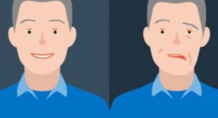 Yüz Felcinin 10 Maddede Nedenleri ve Belirtileri Nelerdir? 