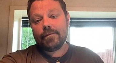 Kedi Sevgisi Hayatına Mal Oldu. Bir 'Kedi Isırığı' Canından Etti!