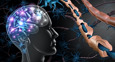 Multiple Skleroz (MS) Hastalığı Nedir Ve Tedavisi Nasıldır? 